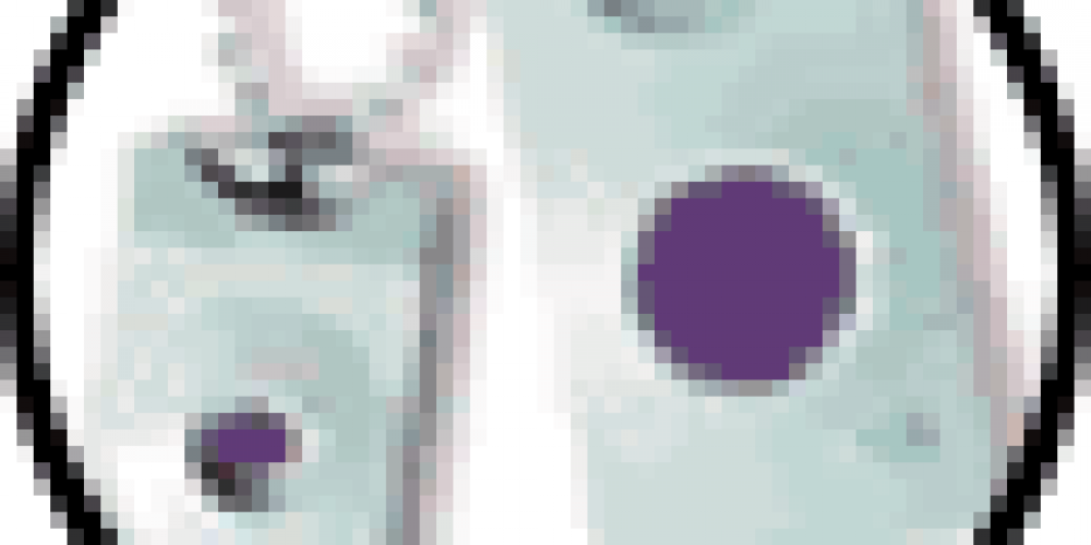 Our Personal Emergency Alarm Buttons